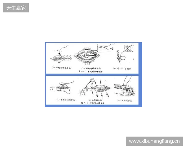 广州豹官方:杨浩眉弓伤口缝合30余针,预计5-7天后拆线 广州豹官方:杨浩眉弓伤口缝合30余针,预计5-7天后拆线